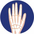 Wrists — joint area Hondrexil is aimed at